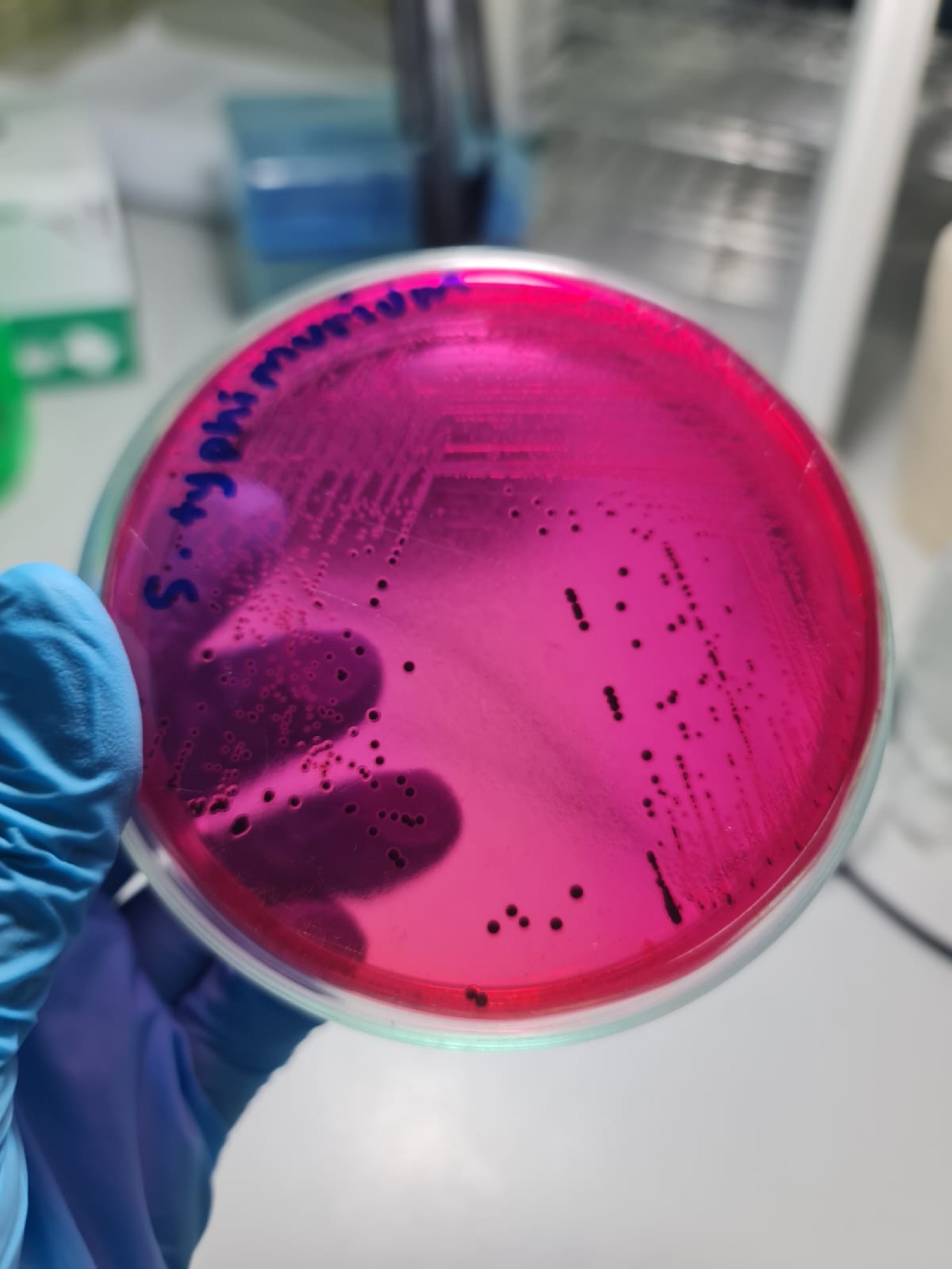 Kewaspadaan terhadap Risiko Salmonellosis Akibat Konsumsi Telur Tidak Higienis